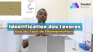 Comment Réaliser un Test de Filamentation  Tutoriel Pratique en Microbiologie [upl. by Ymorej494]