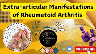 Extraarticular Manifestations of Rheumatoid Arthritis  All you need to know DrMubasshra [upl. by Bethezel601]