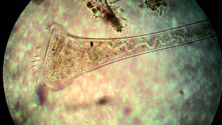 Protist under the microscope [upl. by Mikal527]