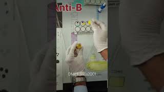 Blood grouptest healthcare dmlt Comment blood group question humanbody science laboratory [upl. by Tallou630]