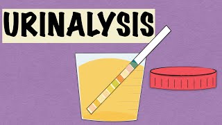 URINALYSIS [upl. by Holtz]