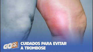 CUIDADOS PARA EVITAR A TROMBOSE [upl. by Htrag]