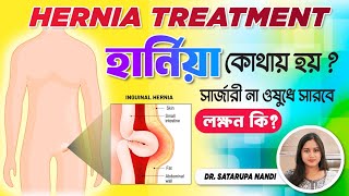 HERNIA TREATMENT। HERNIA SURGERY।হার্নিয়া লক্ষণ পরীক্ষা চিকিৎসা।হার্নিয়া সার্জারি নিয়ে বিস্তারিত [upl. by Uhp]