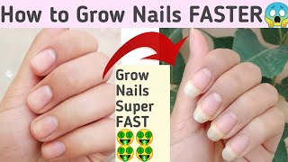 Grow Nails in 1 Week 😱 How to Grow Nails SUPER FAST  How to Whiten Nails  Long Nails Remedy [upl. by Blanding]