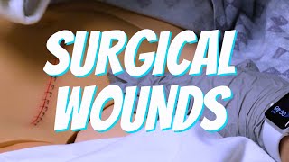 Surgical Wound Care  Nurse Skill Demo [upl. by Reilly]