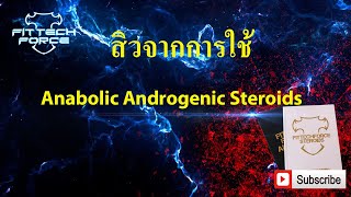 สิวจากการใช้ Anabolic Androgenic Steroids [upl. by Sawyer]