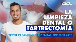 ¿Van a hacerte una LIMPIEZA DENTAL Esto necesitas saber sobre la TARTRECTOMÍA  Dentalk © [upl. by Erised861]