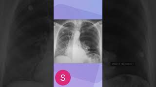 Radiology 13 science healthcare radiology xray [upl. by Nisbet]