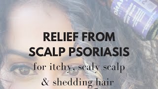 Natural Scalp Psoriasis Relief [upl. by Janaya]