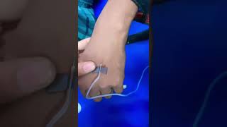 Scalp vein set use ll scalp vein set kese lagaye ll short [upl. by Ajin]