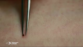 Proper Tick Removal [upl. by Beale]