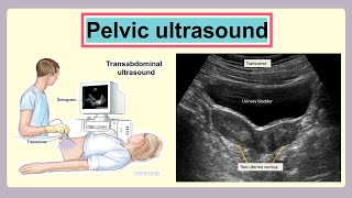 pelvic ultrasound [upl. by Atila]