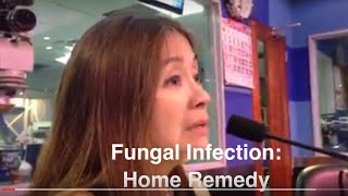 Fungal Infection at Alipunga  Payo ni Dra Katty Go Dermatologist 9 [upl. by Iago]