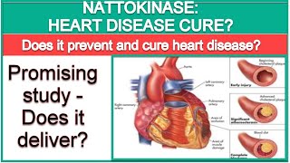 Nattokinase The Cure to Heart Disease [upl. by Luhe877]