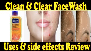 Clean amp Clear Face Wash Review😢  Uses amp Side Effects  Honest Review  Ayeshaa Naeem❤ [upl. by Hugibert]