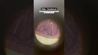 Duodenum histology slide 🙀 histohistombbsabroad duodenum medico russia views fyp [upl. by Jaymie]