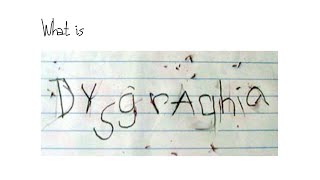 What is Dysgraphia [upl. by Winfield221]