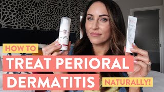 Perioral Dermatitis Treatment  Juli Bauer Roth [upl. by Victorie]