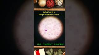 Peripheral Blood Smear Examination  PBF  Microscopy  Pathology  DMLT  BMLT  MLT STUDY [upl. by Aliek]