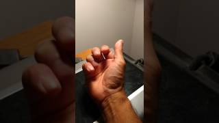 Simple rehabilitation for mallet finger after partial removal of splint [upl. by Ardnnek906]