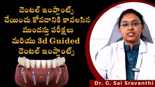 PreRequisites for Dental Implants and Advanced Guided implants  Dr GSai Sravanthi [upl. by Kris]