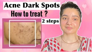 How to REMOVE DARK SPOTS from Face NATURALLY ACNE SPOTS [upl. by Mclaughlin]