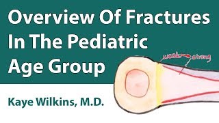 Overview Of Fractures In The Pediatric Age Group [upl. by Moriarty]