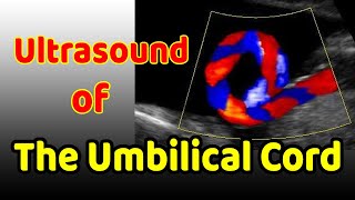 Ultrasound of the Umbilical Cord [upl. by Htevi319]