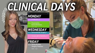 A Week in the Life of a Dental Student in EUROPE  Virtual Clinical 3day Vlog Experience [upl. by Adnerol703]