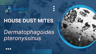 House Dust Mites  under the microscope at airmid healthgroup [upl. by Burner]