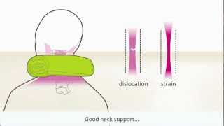 Whiplash  Symptoms and treatment [upl. by Trilby948]