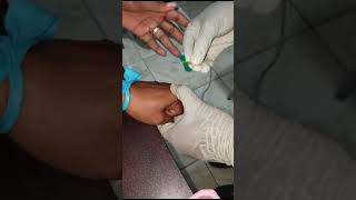 Butterfly needle dorsal venipuncture Avagale practicalsession IAHJA [upl. by Tterej]