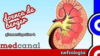 Doença de Berger  GLOMERULOPATIAS 4 [upl. by Macdougall]