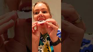 opalescence 16 carbamide peroxide professional home teeth whitening how to use guide by a dentist [upl. by Nwahsid575]