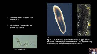 BIOL 1407 Lab 37 Platyhelminthes [upl. by Nivled15]