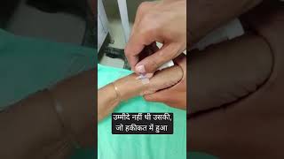 cannulation 🎯🤍🩺training time doctor lover motivation medical shorts video neet viralvide [upl. by Annahaj115]