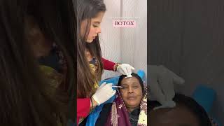 Botox Treatment For Face  Botox Injection  Dr Muskan Tyagi  Dermalyn Aesthetics [upl. by Oag895]