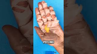 Why Your Skin Peels Like This trending feedshorts education [upl. by Lyontine]