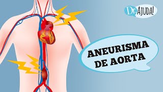 ANEURISMA DE AORTA O QUE É SINTOMAS E TRATAMENTO [upl. by Constantino]