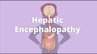 Cirrhosis – Hepatic encephalopathy [upl. by Nessie]