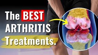 Knee Arthritis Treatments Proven to Work  The Truth You Need to Know [upl. by Gilson739]