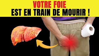 12 signes étranges que votre foie est GRAVEMENT malade [upl. by Ott355]