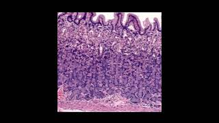 Histology of the StomachLecturePart 1 [upl. by Hudson548]