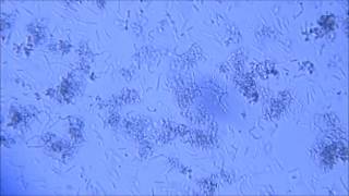 LACTOBACILLUS ACIDOPHILUS  LACTOBACILLUS RHAMNOSUS [upl. by Noval]