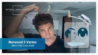 Norwood 3 Vertex Male Pattern Baldness Men’s Hair Loss Scale Explained [upl. by Broadbent]