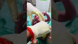 Vernix cleaning newbornbaby baby cute beautiful newborn trending babygirl cutebaby [upl. by Harrow101]