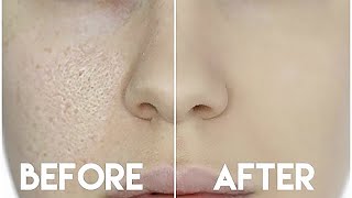 HOW TO HIDE ENLARGED PORES amp MAKE YOUR PORES DISAPPEAR [upl. by Mohammed]