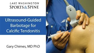 Ultrasoundguided Barbotage for Calcific Tendinitis [upl. by Cherye441]