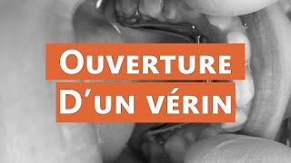 Ouverture dun écarteur [upl. by Amihc]