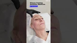 Ellanse Training  Aesthetic Medicine College Dublin [upl. by Yruj]